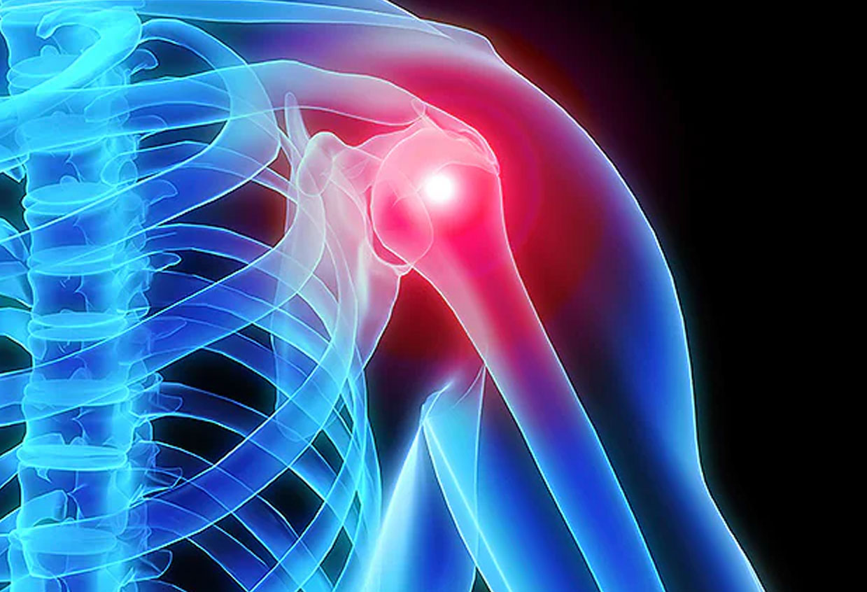 loy-chiro-shoulder-pain